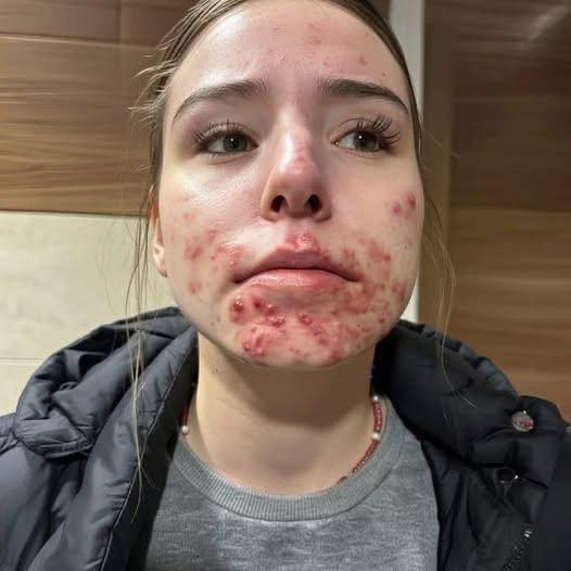 These are the first symptoms of sleeping with…